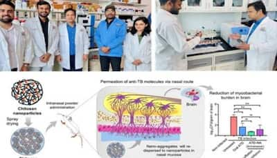 Scientists Develop Novel Nose-To-Brain Drug Delivery For Tuberculosis Treatment