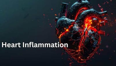 Understanding Heart Inflammation: Causes, Symptoms, And Treatment