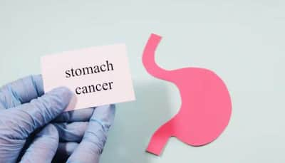 Can Your Diet Help Prevent Stomach Cancer? The Science Behind The Plate