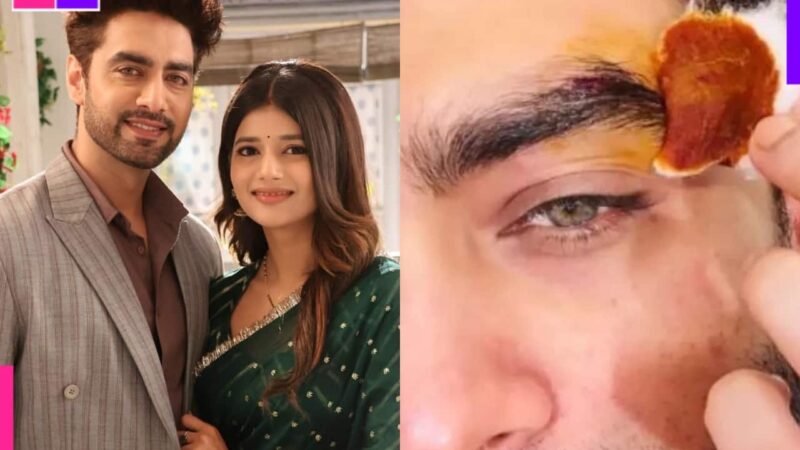 Yeh Rishta Kya Kehlata Hai: Rohit Purohit suffers eye injury on the sets? Know what exactly happened