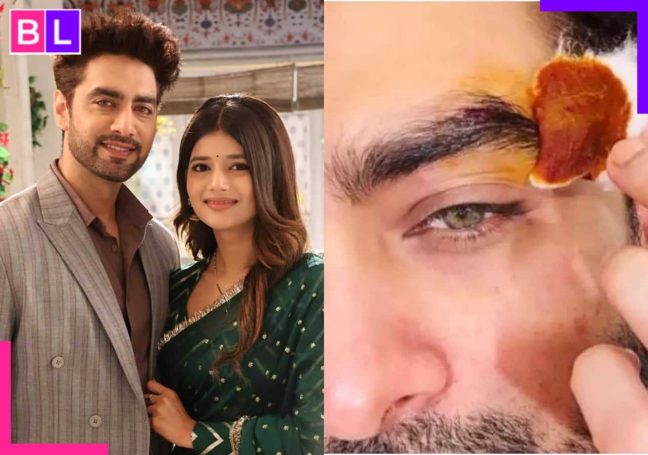 Yeh Rishta Kya Kehlata Hai: Rohit Purohit suffers eye injury on the sets? Know what exactly happened