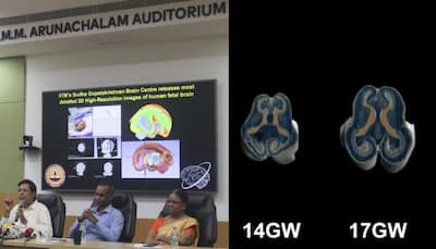 IIT Madras Unveils World’s Most Detailed 3D Images Of Foetal Brain