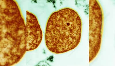 How Ancient Archaea Survive Extreme Heat: Insights From Indian Scientists' Research