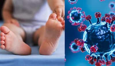 HMPV Virus Now In India! First Case Reported From Bengaluru Hospital; 8-Month-Old Baby Tests Positive