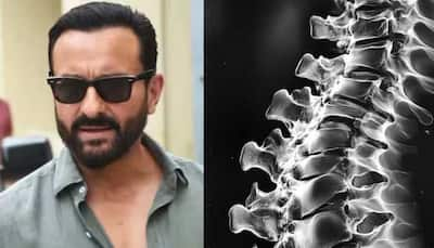 Saif Ali Khan Suffered Thoracic Spinal Chord Injury, Spinal Fluid Leaked: Doc Shares How Dangerous It Is