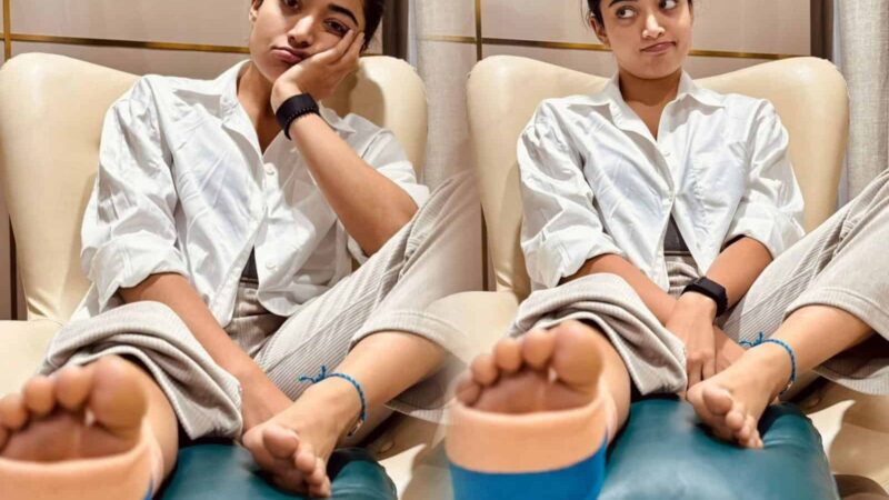 Pic Talk: Rashmika’s Leg Injury