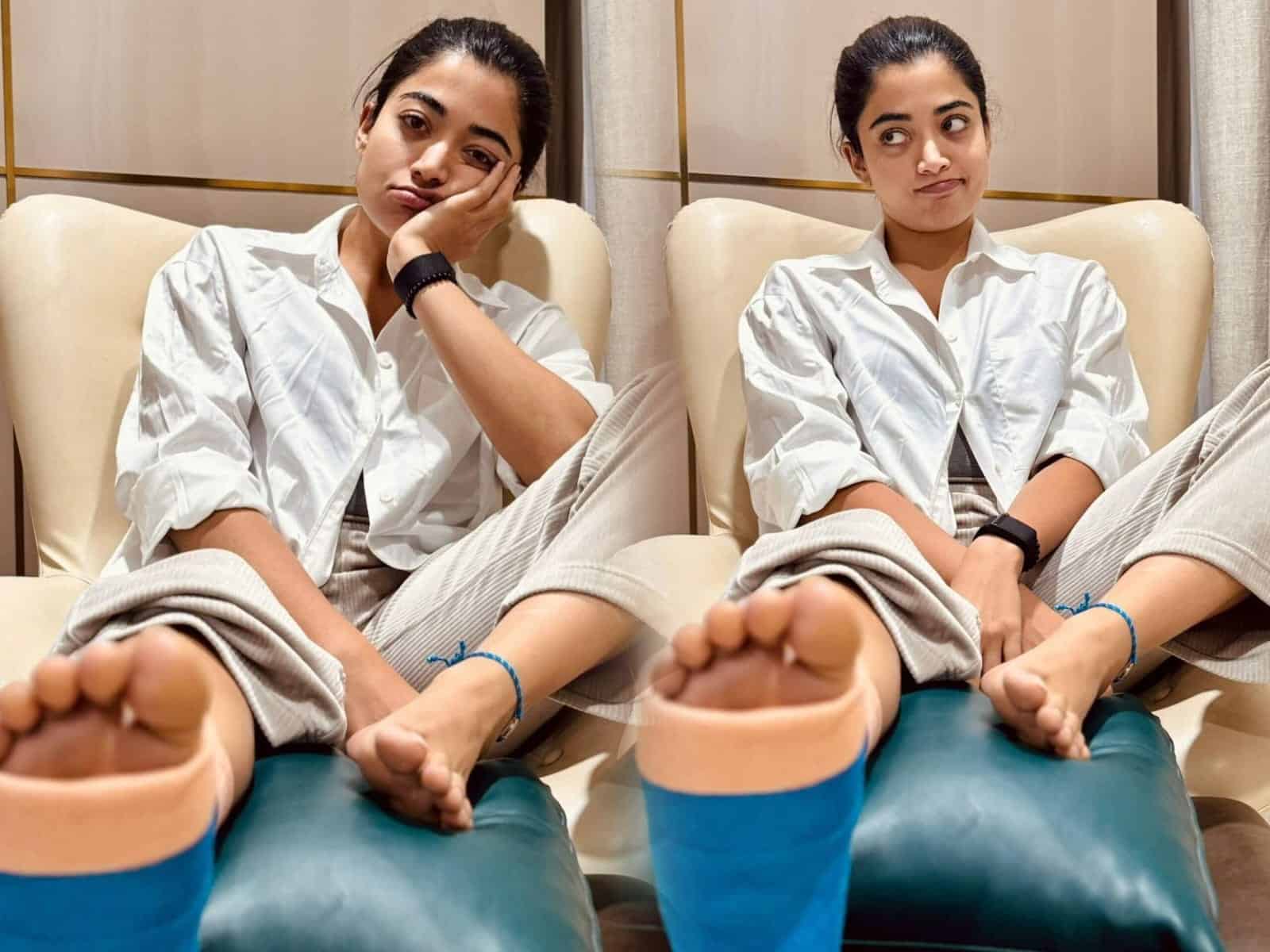 Pic Talk: Rashmika’s Leg Injury