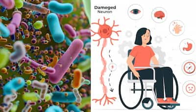 Gut Microbiome Linked To Multiple Sclerosis Onset: Yale Study Reveals Key Bacterial Imbalance