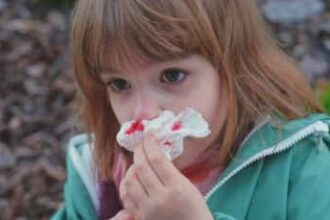 Why Do Kids Get More Nosebleeds In Summer? Causes And Solutions
