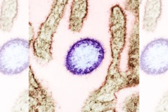 Nipah virus from an infected VERO cell | Commons