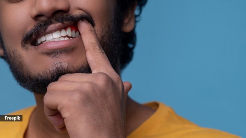 Dentists often respond to this concern with a quick fix: applying white composite fillings near the gum line
