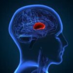 World Brain Tumour Day 2025: Warning Signs You Must Not Ignore For Early Detection And Better Survival