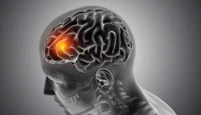 Potential Of Stem Cell Therapy In Brain Tumour Treatment
