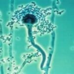 Invisible Killer in the Air: A Deadly Fungus Creeping Across America’s Lungs