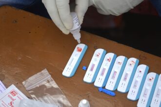 HIV test