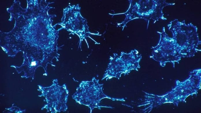 Cancer cells can survive in the body using specific enzymes | Representational image | Pixabay