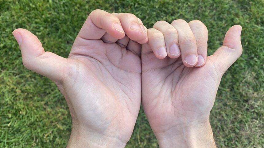 The health risks of being double-jointed