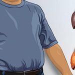 Fatty liver disease