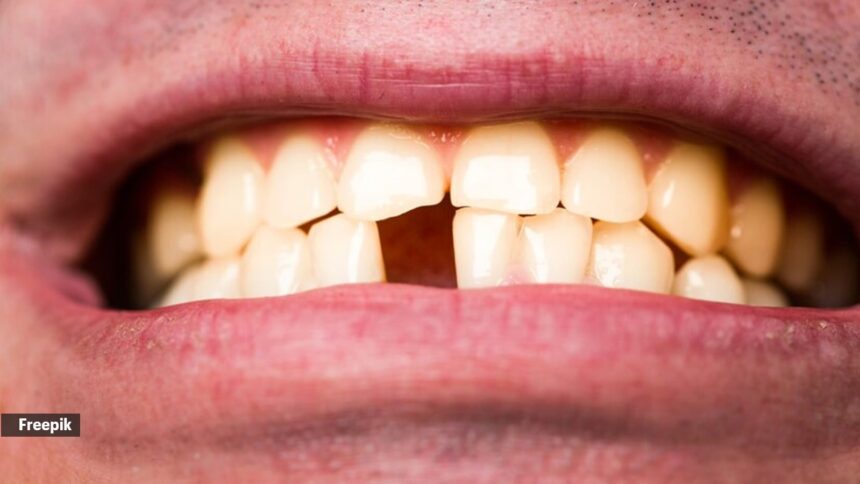 "If someone is losing one tooth because of bad dental health, chances are they will continue to lose more teeth," said Dr Karan Rajan in his video