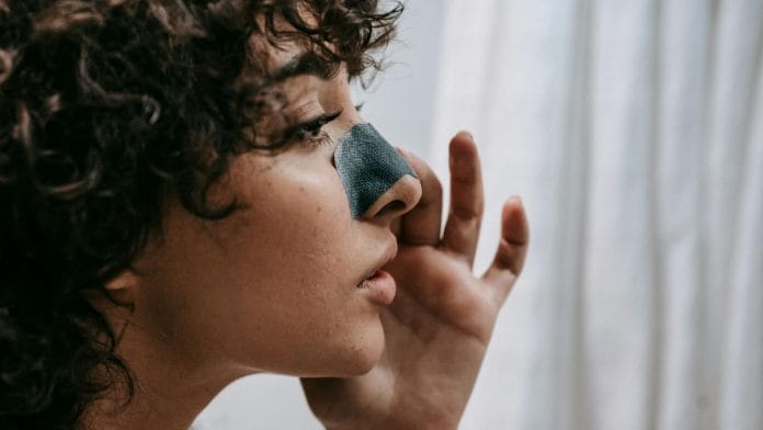 blackheads
