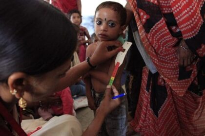 File photo of a child’s upper arm being measured at an Anganwadi centre in Madhya Pradesh’s Dhar district to check for malnutrition. | Commons