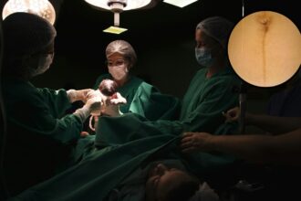 cesarean