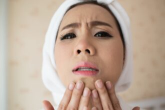 face bloating