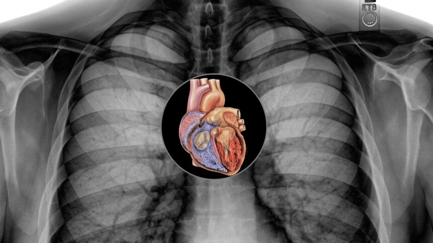 heart