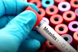 Bangladesh is facing a worsening measles outbreak, with more than 488 deaths and over 59,000 suspected infections reported across 58 districts. (File Photo)