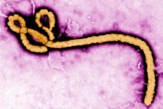 This undated colorized transmission electron micrograph file image made available by the Centers for Disease Control and Prevention (CDC) shows an Ebola virus virion. (AP)