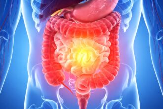 Gut health myths continue to circulate widely on social media