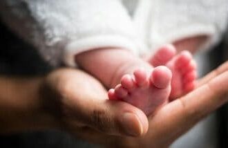 Jaundice is extremely common in newborns, triggered by the buildup of a yellow pigment called bilirubin in the blood.